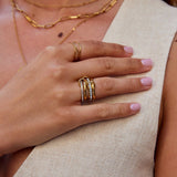 Anita™ — Anello